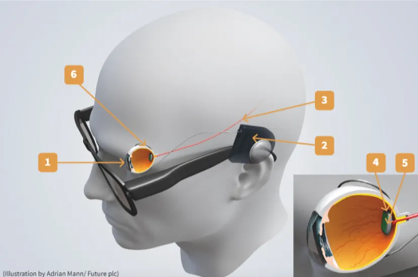  Bionic eyes technology